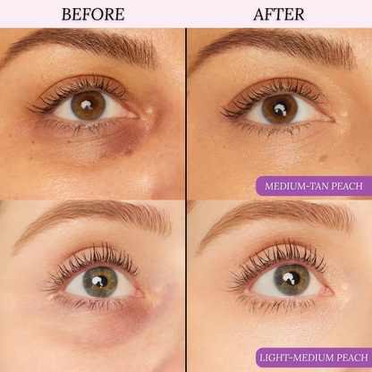 Awake™ Under-Eye Corrector