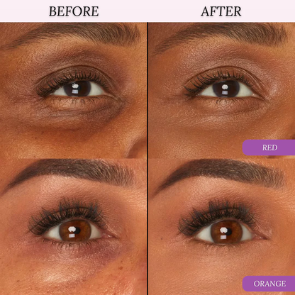 Awake™ Under-Eye Corrector